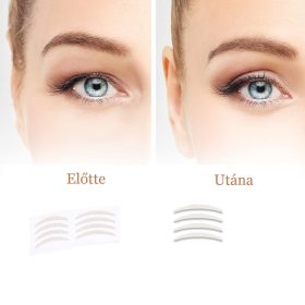  Szemhéj feszesítő tapasz megereszkedett szemekre (közép csomag-100 db)